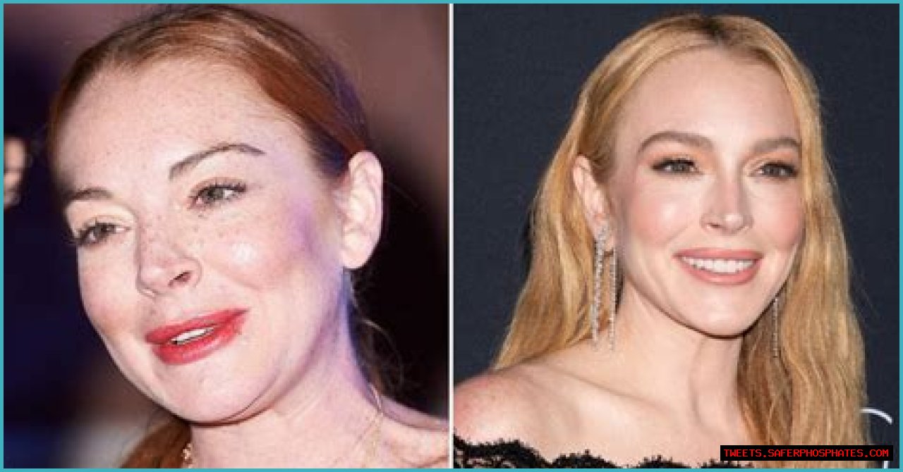 Unveiling The Secrets Of Lindsay Lohan's Nose Job: Discoveries And Insights